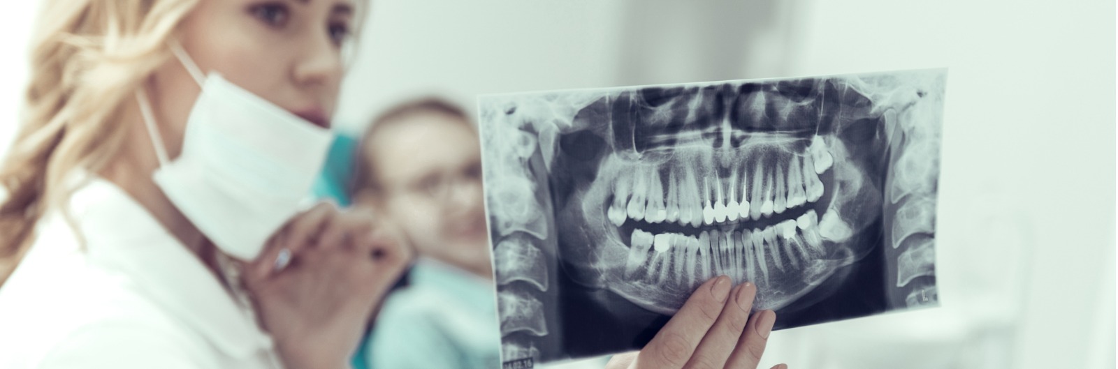 results-of-an-xray-in-the-hands-of-a-young-dentist-picture-1600x529.jpg