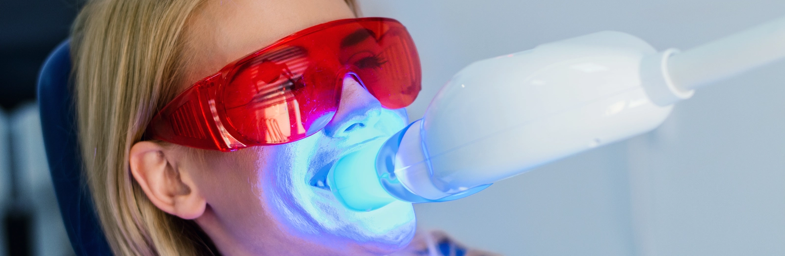 woman-getting-her-teeth-whitened-1600x522.webp