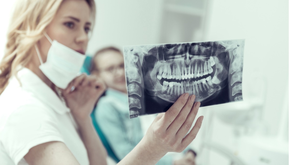 results-of-an-xray-in-the-hands-of-a-young-dentist-picture-1200x683.jpg