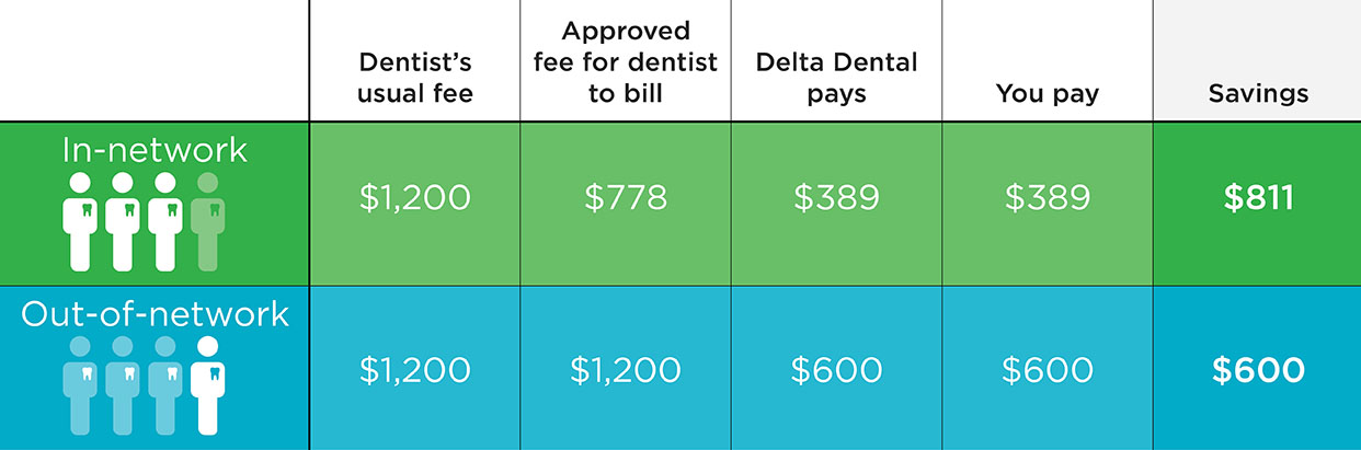 In Network Dentist Benefits Out Of Network Dentist