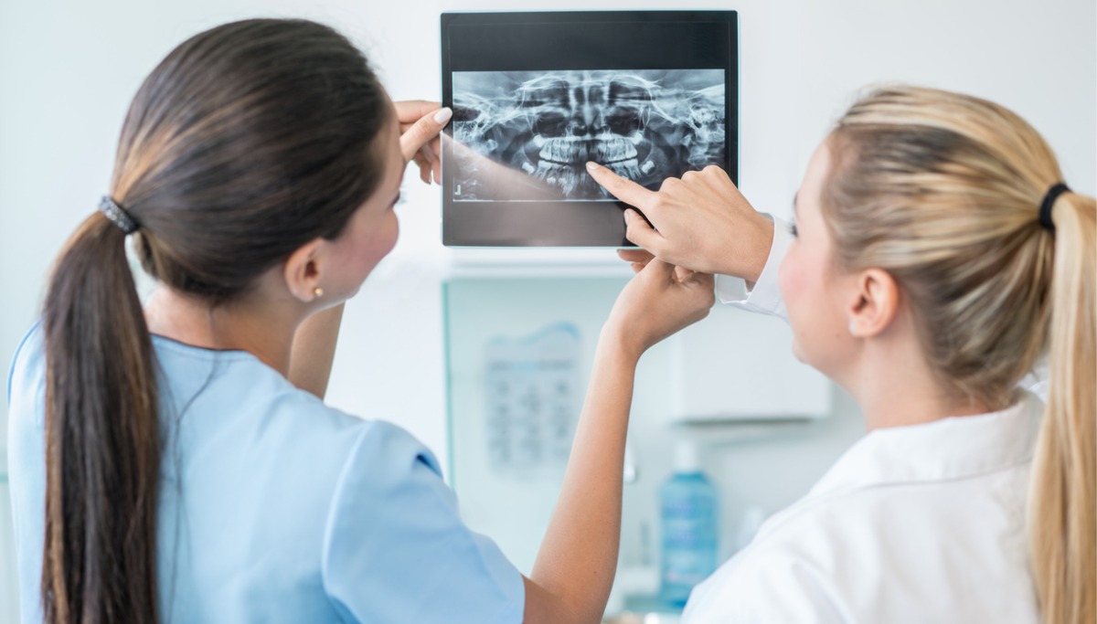 Two dentist looking at an x-ray of a mouth 