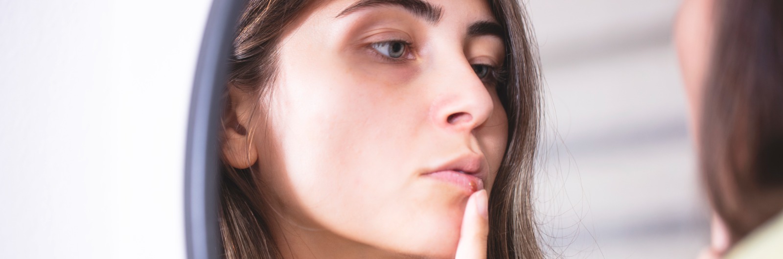 A woman touching a sore on her lip
