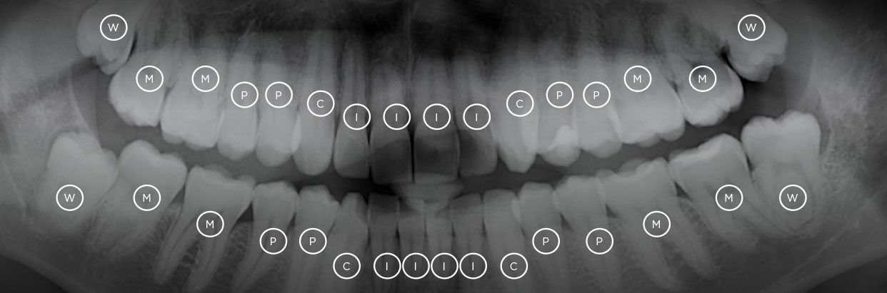 10174-6_Spring_Wellness_XRay_1242x411.jpg