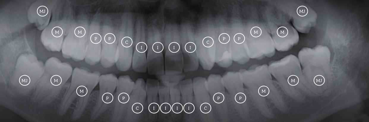 es-10174-6_Spring_Wellness_XRay_1242x411.jpg