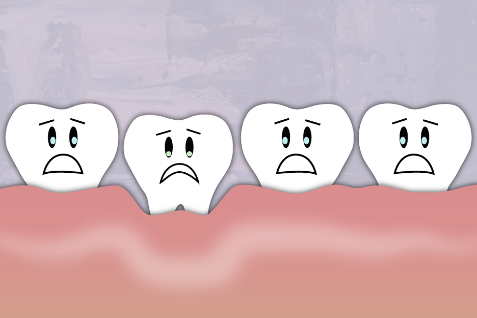 Can receding gums grow back naturally?
