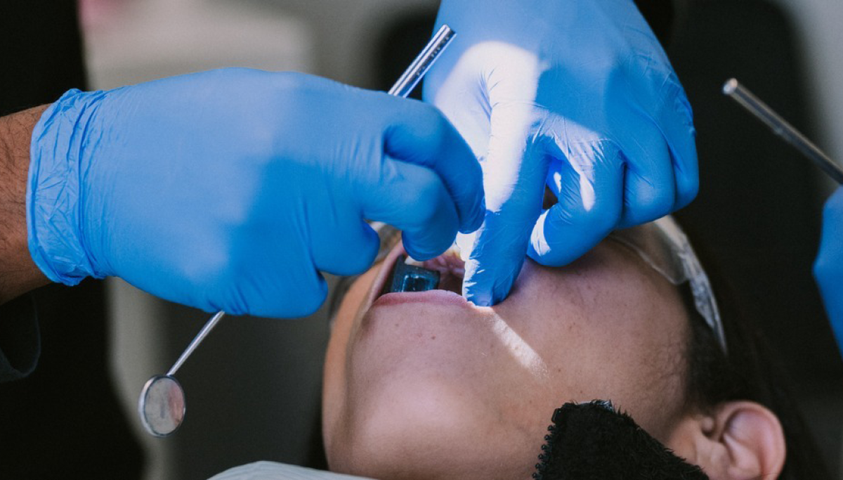 How are cavities filled?