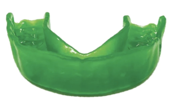 Mouth guard after molding with custom imprints of teeth